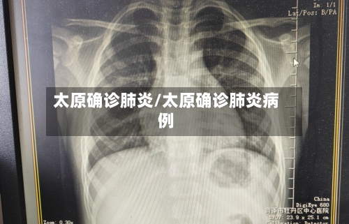 太原确诊肺炎/太原确诊肺炎病例-第1张图片