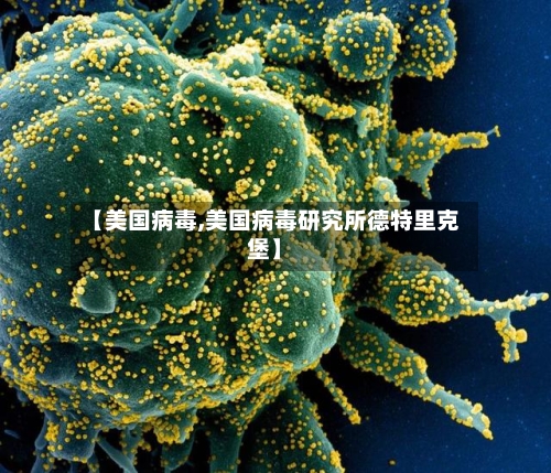 【美国病毒,美国病毒研究所德特里克堡】-第1张图片